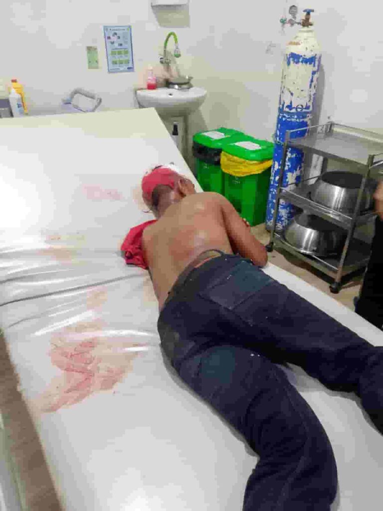 Sadis, Sekelompok Pemuda Bacok Sekuriti Gudang di Labuhan Deli Sadis, Sekelompok Pemuda Bacok Sekuriti Gudang di Labuhan Deli