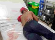 Sadis, Sekelompok Pemuda Bacok Sekuriti Gudang di Labuhan Deli