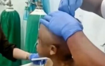 Bocah 7 Tahun Diduga Disiksa Pengasuh, Luka di Sekujur Tubuh hingga Alat Kelamin